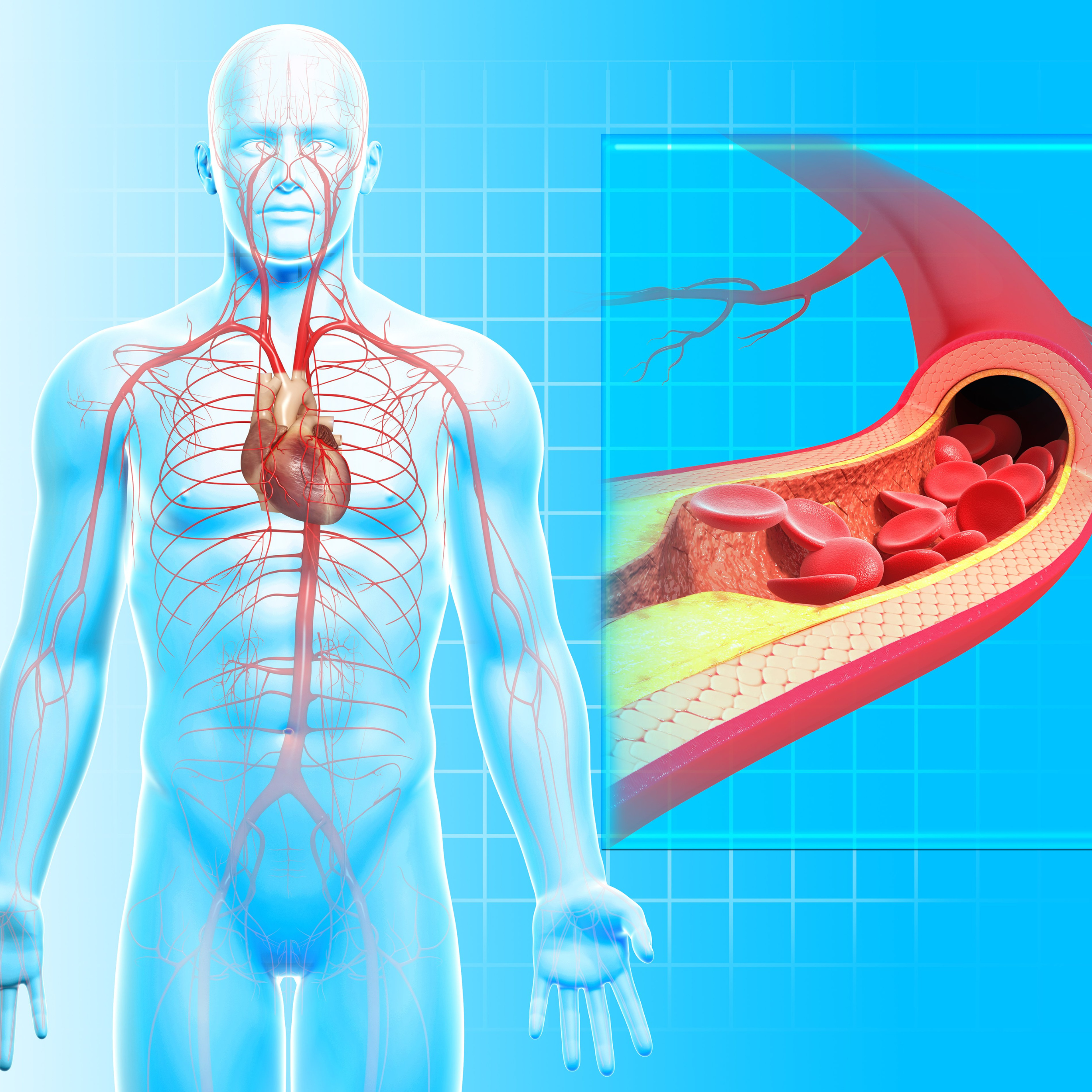 Problemas circulatorios