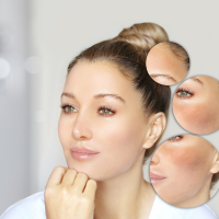 Clasificación de la piel