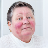 Alteraciones de la piel