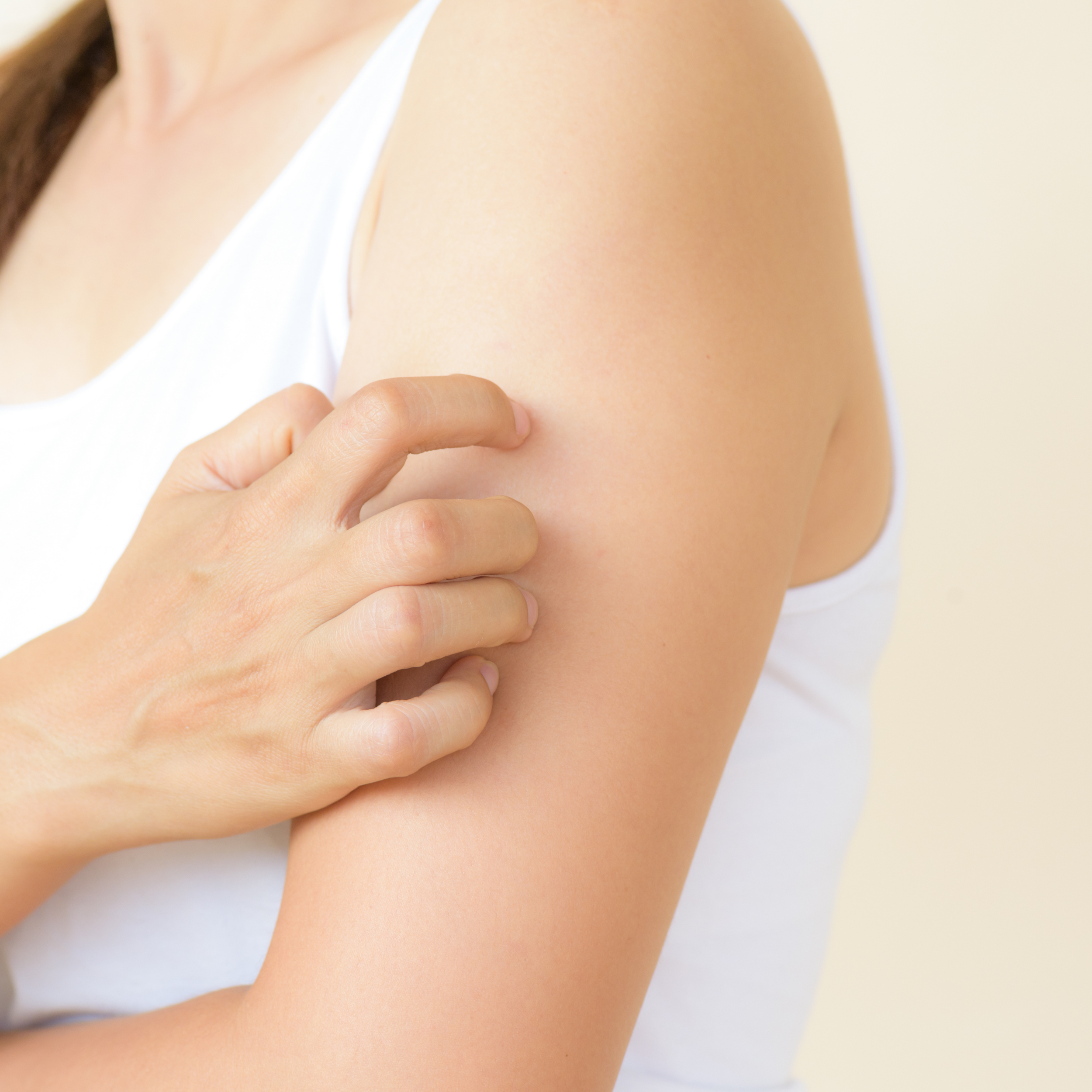 Alteraciones de la piel